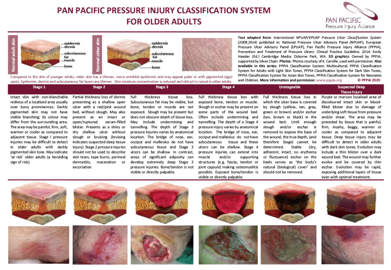 Illustration of resource describing the Pan Pacific Pressure Injury Classification System for Older Adults.  